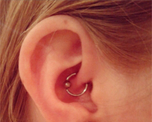 Daith piercing deals